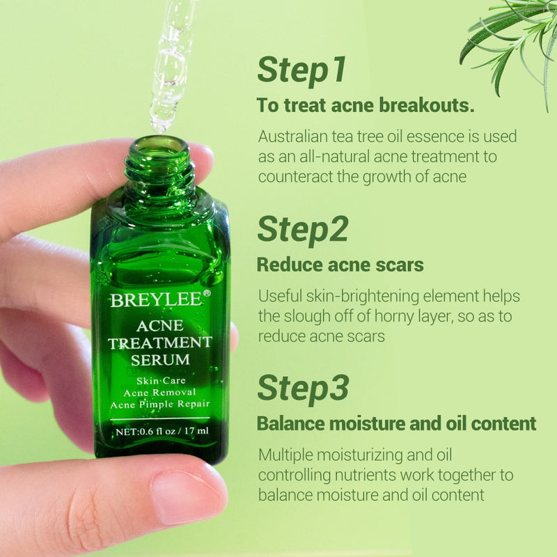 Acne Treatment Face Serum